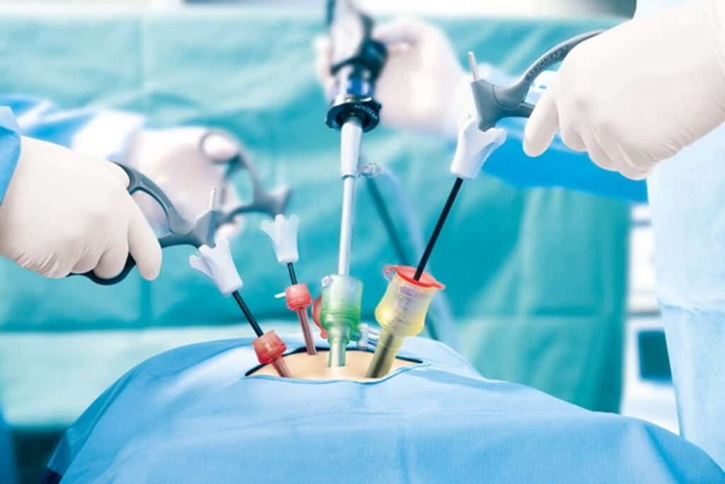 Laparoscopic Hysterectomy