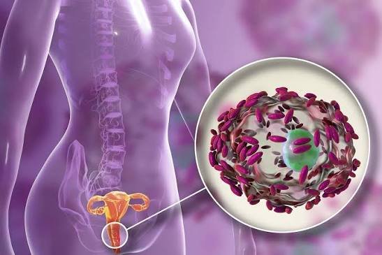 Vaginal Infections and Women's Health
